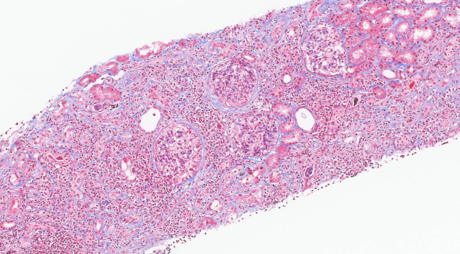 Ri Staining Pattern IHC & IF & Special Stains – Pacific Rim Pathology